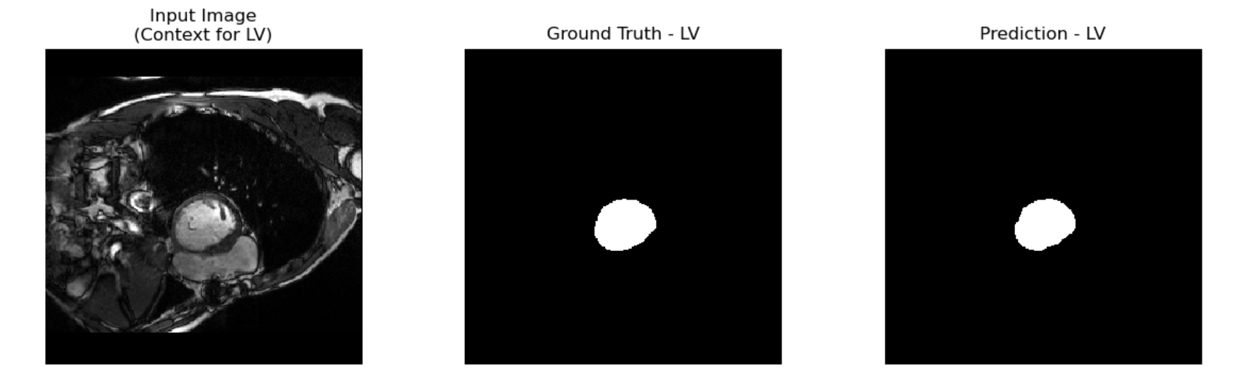 Attention U-Net Segmentation Example LV