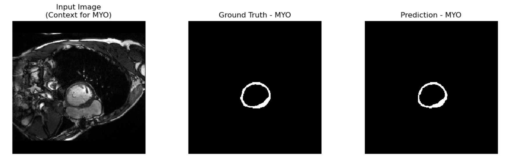 Attention U-Net Segmentation Example MYO