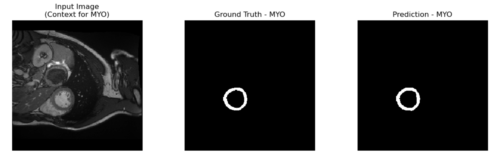 Baseline Segmentation Example MYO