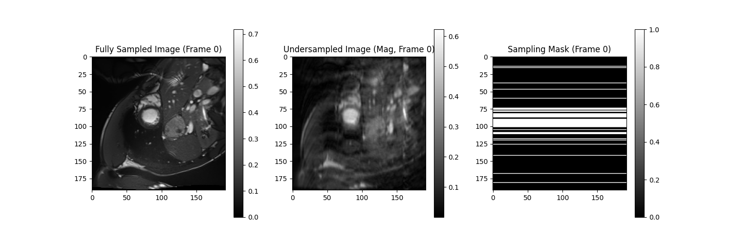 Undersampling Patterns Frame 0