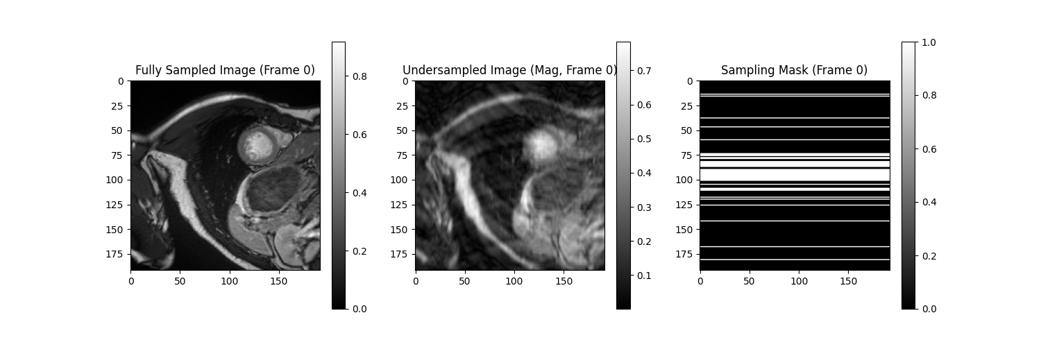 Undersampling Patterns Frame 1