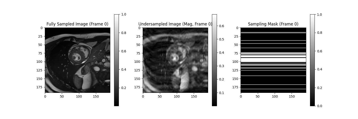 Undersampling Patterns Frame 2