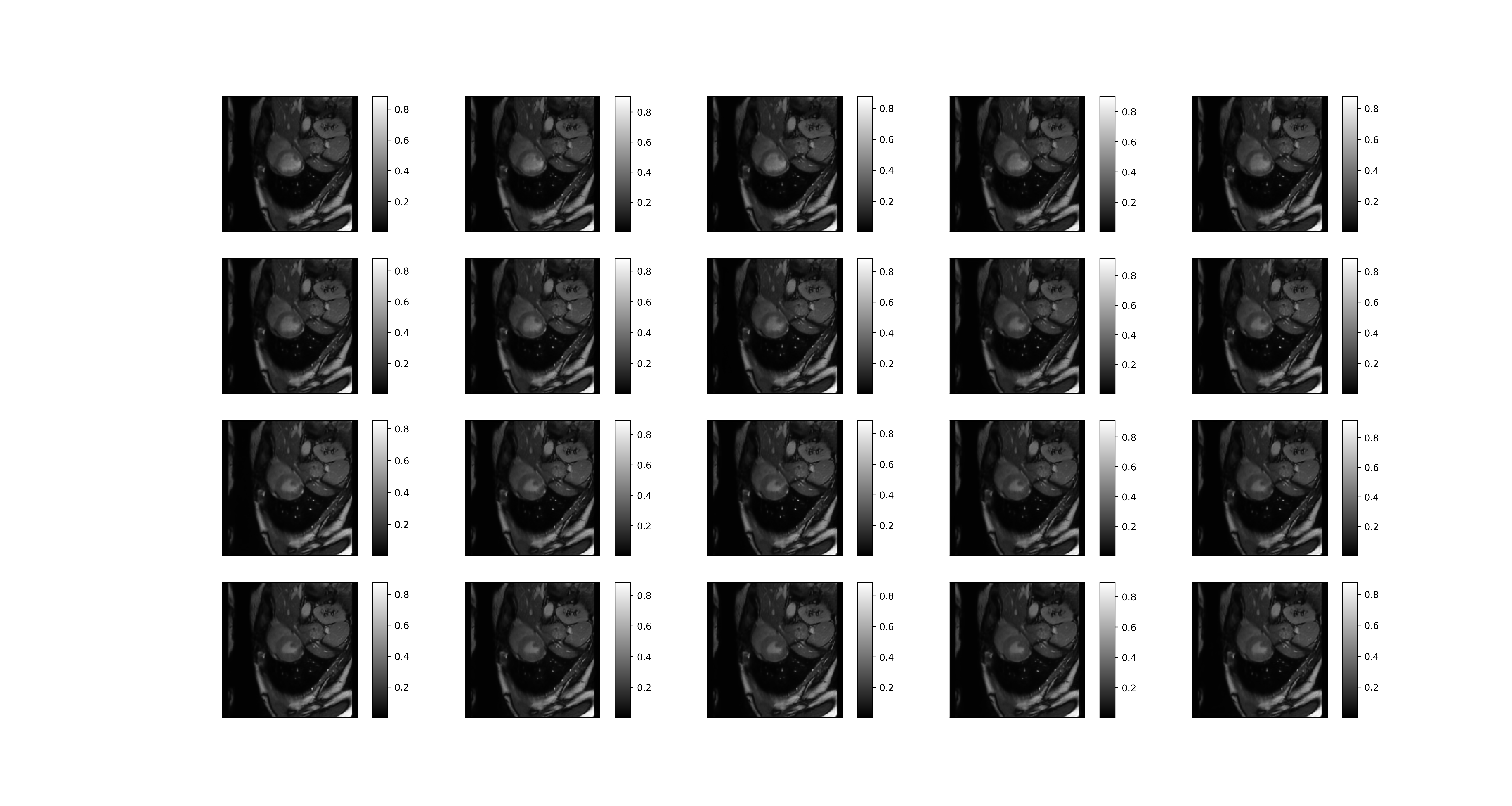 Reconstructed Image1